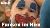 Funken im Hirn